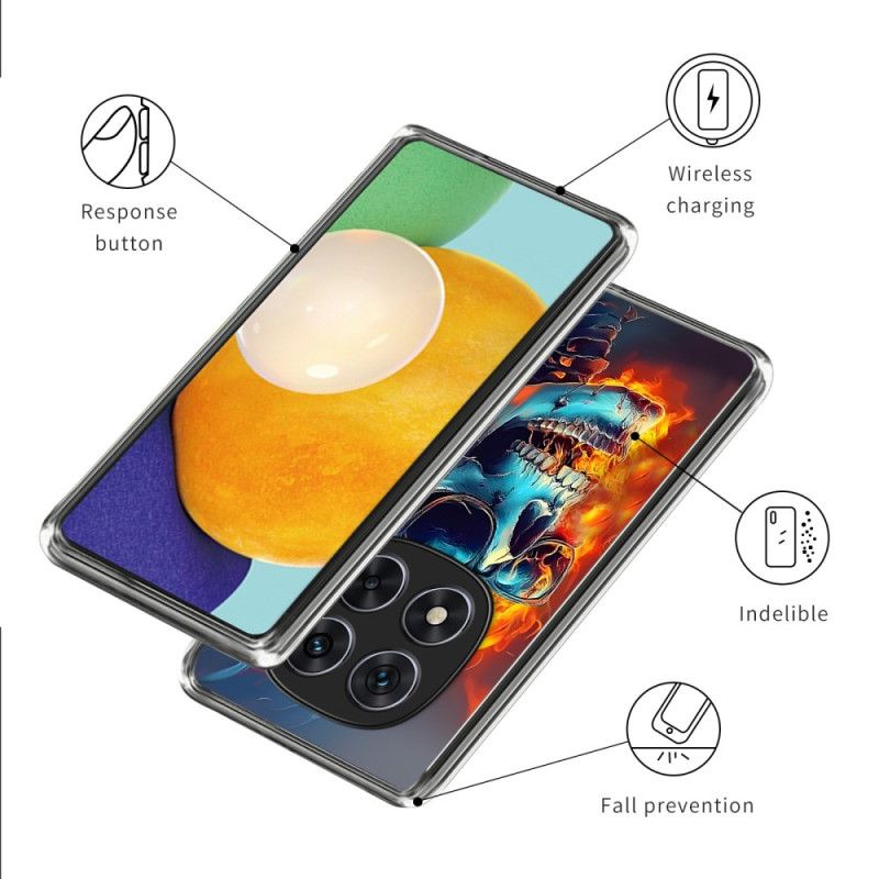 Cover Til Xiaomi Redmi Note 14 Pro 4g Flammende Kranium